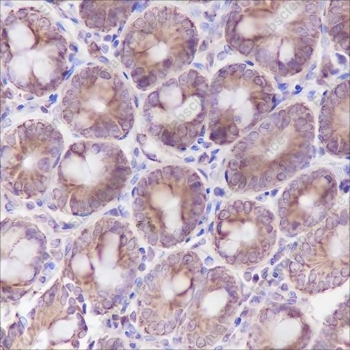 Recombinant Cpn10 Monoclonal Antibody - 3