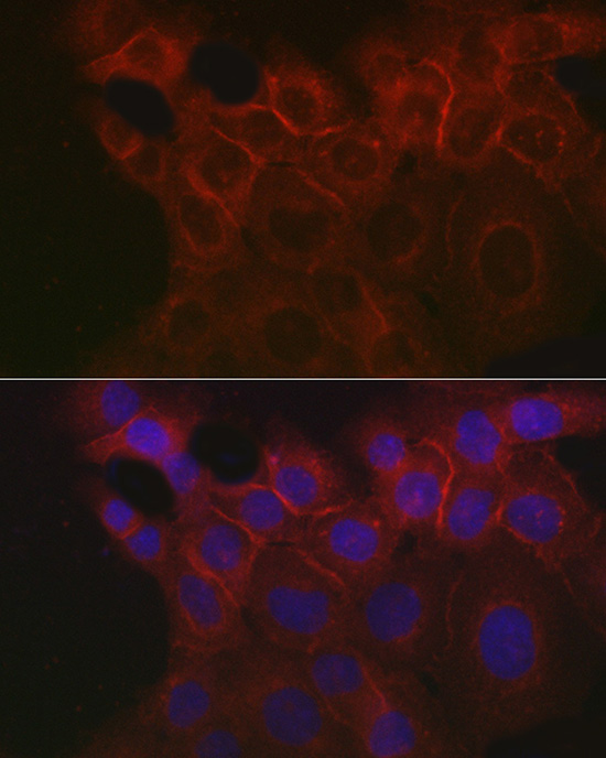 Immunofluorescence analysis of A431 cells using EpCAM Polyclonal Antibody at dilution of 1:100 (40x lens). Blue: DAPI for nuclear staining.