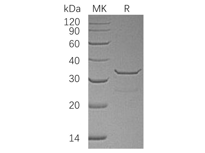 Recombinant Human SULT1B1 Protein (His Tag)