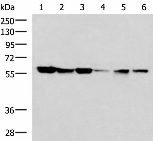 Western blot analysis of 293T 231 K562 Jurkat and Hela cell lysates  using FKBP4 Polyclonal Antibody at dilution of 1:700