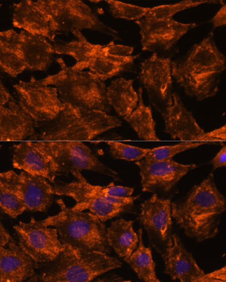 Immunofluorescence analysis of C6 cells using ITSN2 Polyclonal Antibody at dilution of  1:100. Blue: DAPI for nuclear staining.