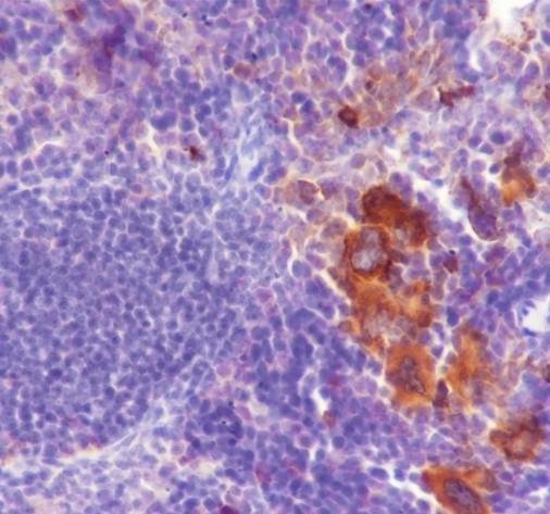 Recombinant TGF beta 1 Monoclonal Antibody - 3