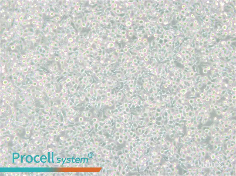 MM.1S Cell Complete Medium - 3