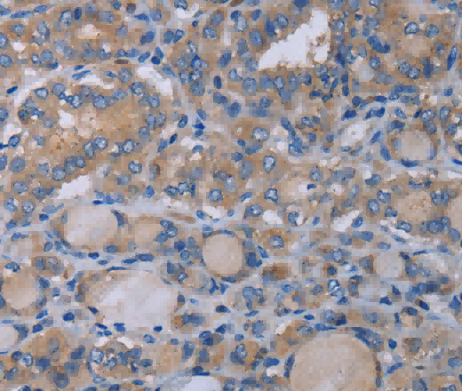 P2RX3 Polyclonal Antibody - 2