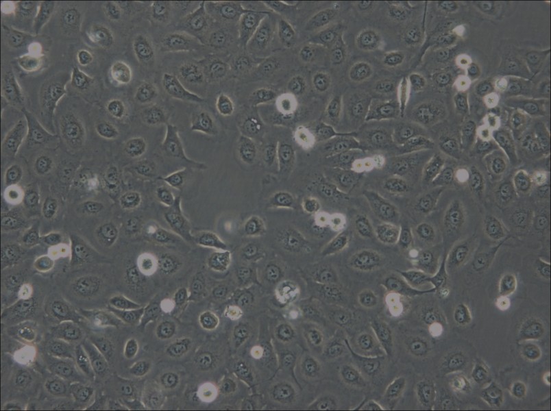 OVCA429 Cell Complete Medium - small - 6