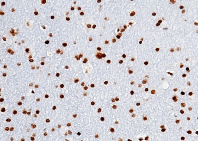 Recombinant Olig-2/Oligo2 Monoclonal Antibody - small - 2