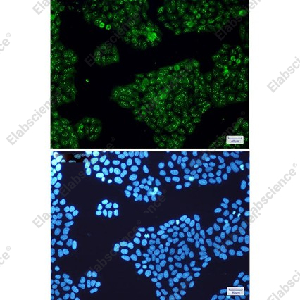 Recombinant Calretinin Monoclonal Antibody - 2