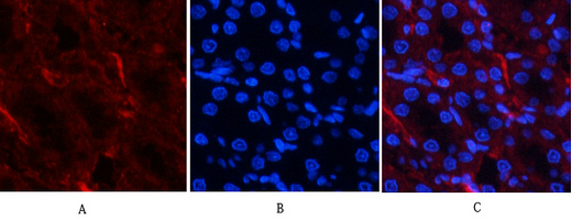 Recombinant Phospho-Akt (Thr308) Monoclonal Antibody - small - 4