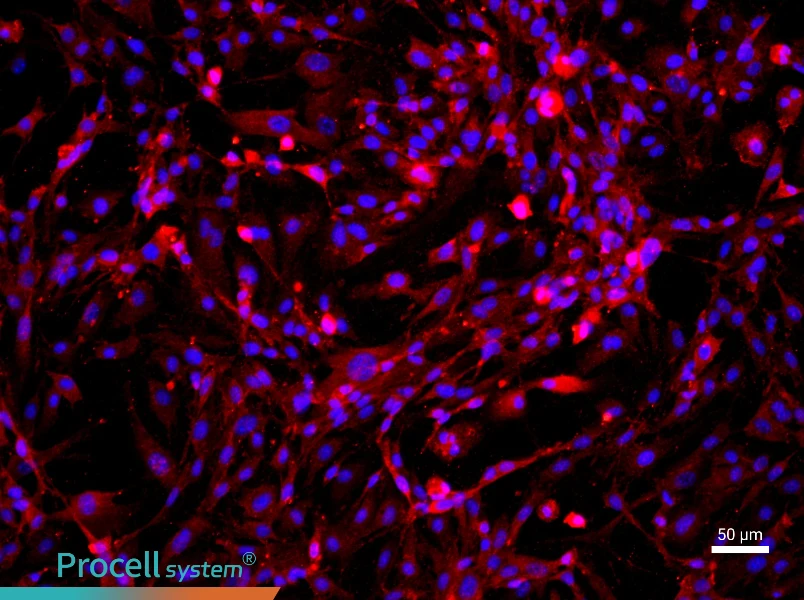 Rat Cavernous Endothelial Cell Complete Medium - 1