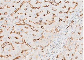 CD36/SCARB3 Monoclonal Antibody - small - 2