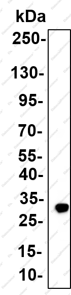 Recombinant S5A2 Monoclonal Antibody - 3