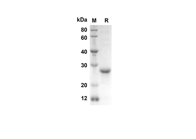 Recombinant Human IL17D Protein(Sumo Tag)-产品推荐-1