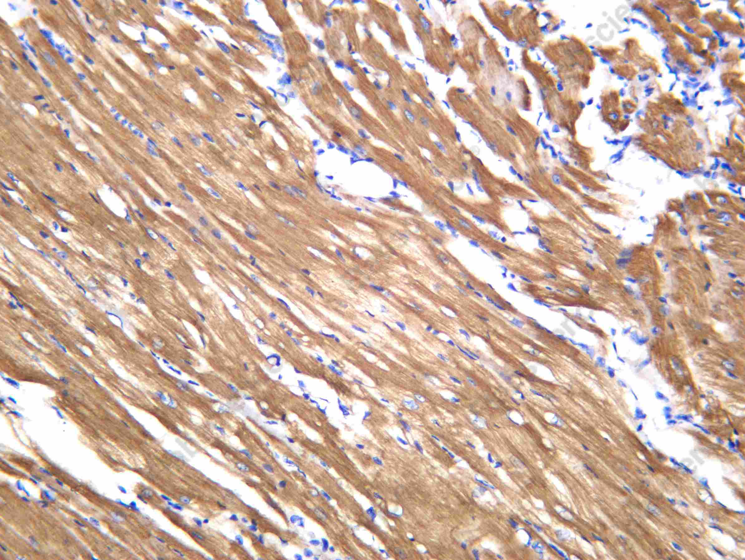 Recombinant MYL3 Monoclonal Antibody - 3