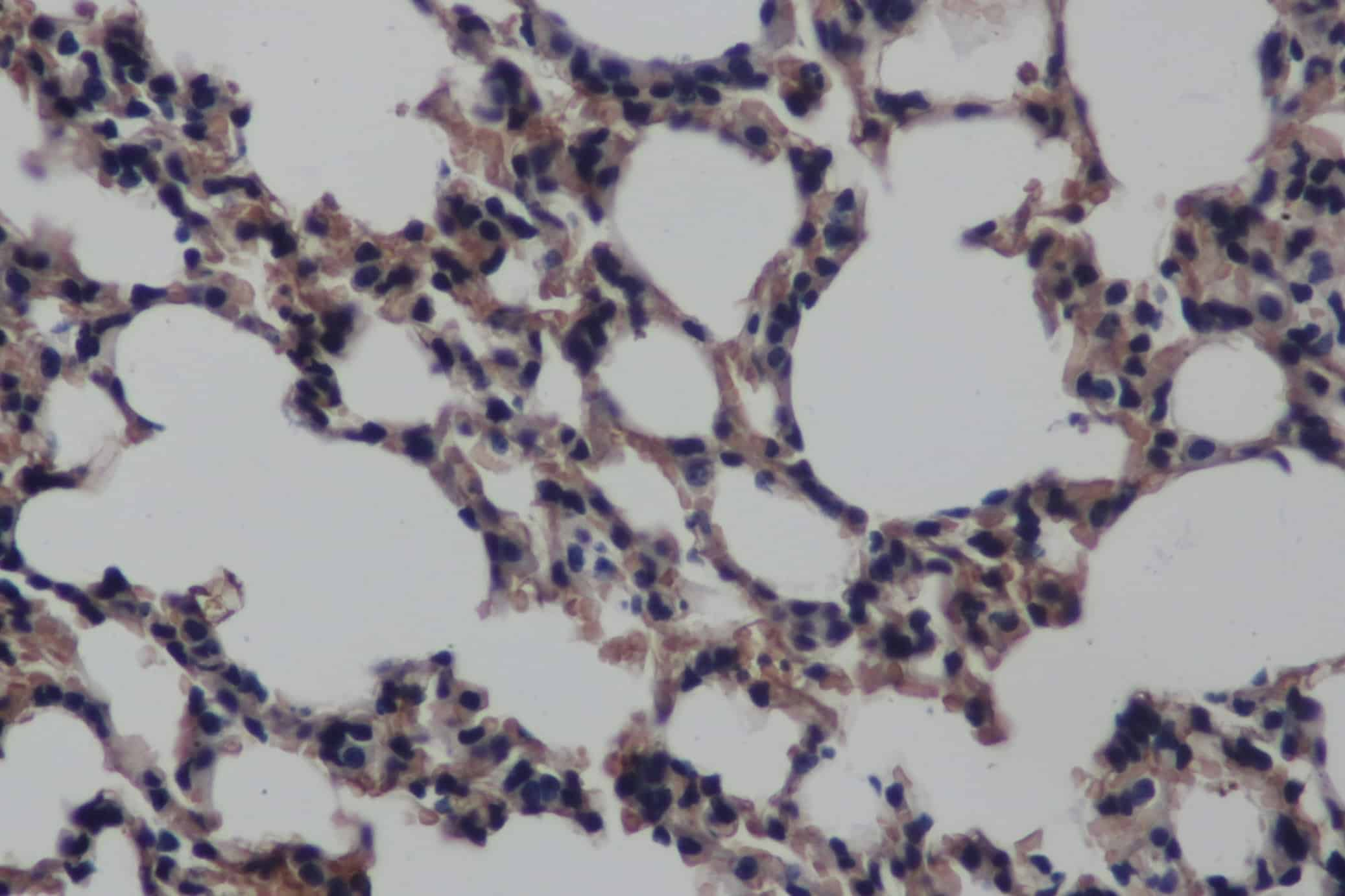 Immunohistochemistry of paraffin-embedded Mouse lung using JNK1 Polyclonal Antibody at dilution of 1:50