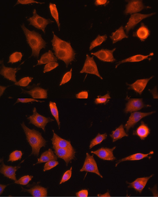 Immunofluorescence analysis of L929 cells using PFKM Polyclonal antibody at dilution of 1:100 (40x lens). Blue: DAPI for nuclear staining.