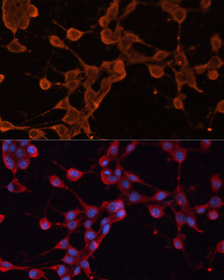 Immunofluorescence analysis of NIH/3T3 cells using ABCB11 Polyclonal Antibody at dilution of 1:100. Blue: DAPI for nuclear staining.