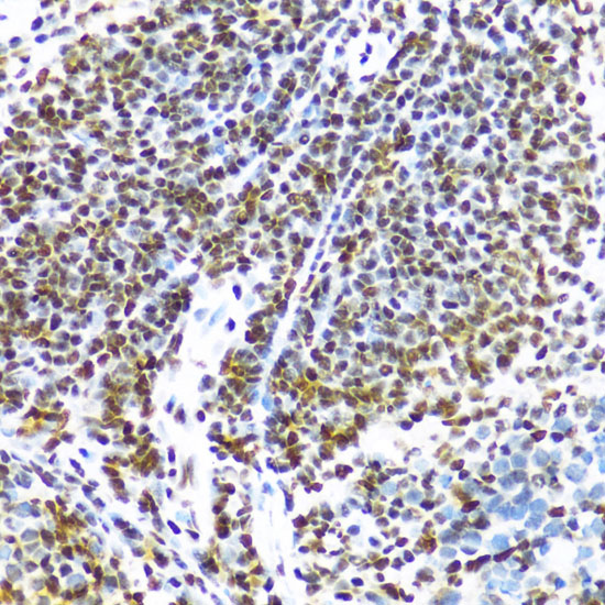 Immunohistochemistry of paraffin-embedded mouse spleen using FUS Polyclonal Antibody at dilution of 1:100 (40x lens).Perform microwave antigen retrieval with 10 mM PBS buffer pH 7.2 before commencing with IHC staining protocol.