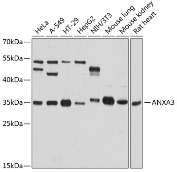 Western blot analysis of extracts of various cell lines using ANXA3 Polyclonal Antibody at 1:3000 dilution.