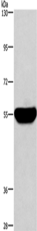 Western Blot analysis of Human fetal liver tissue using HMGCS1 Polyclonal Antibody at dilution of 1:300