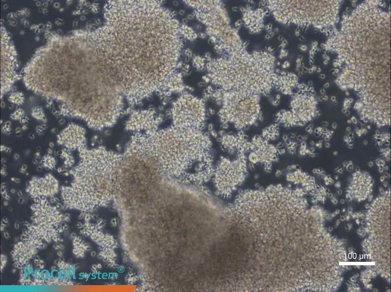 NCI-BL2009 Cell Complete Medium - 3