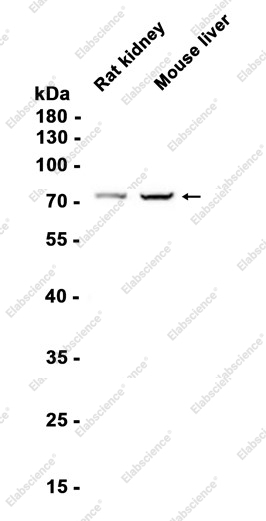 Recombinant CPT2 Monoclonal Antibody - 1