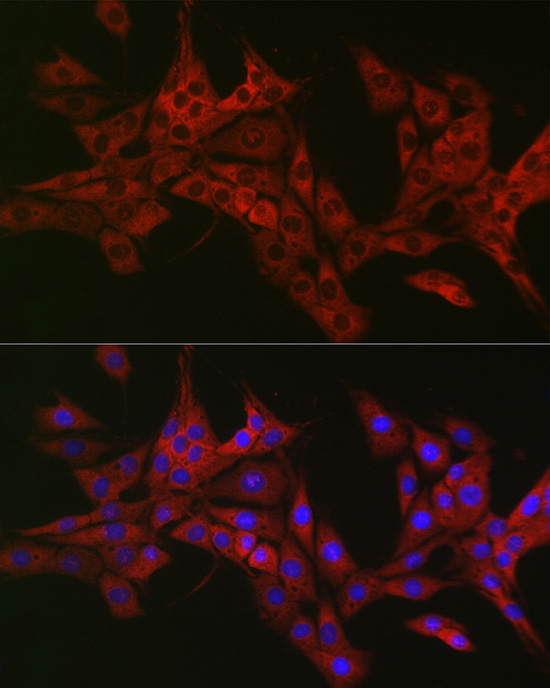 Immunofluorescence analysis of PC-12 cells using TRAF3IP2 Polyclonal antibody at dilution of 1:50 (40x lens). Blue: DAPI for nuclear staining.