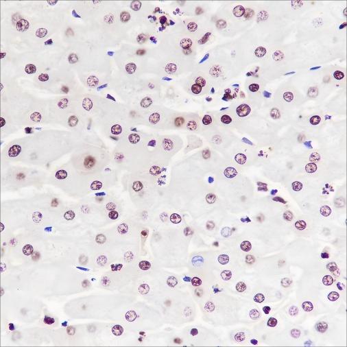 Recombinant NPM1 Monoclonal Antibody - 2