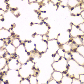 Immunohistochemistry of paraffin-embedded Mouse lung using PIP4K2A Polyclonal Antibody at dilution of  1:100 (40x lens).