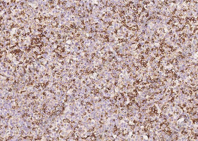 CD45/PTPRC Monoclonal Antibody - 1