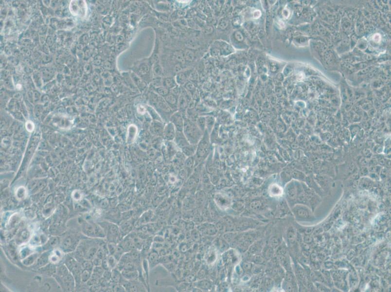 NCI-H1793 Cell Complete Medium - small - 6