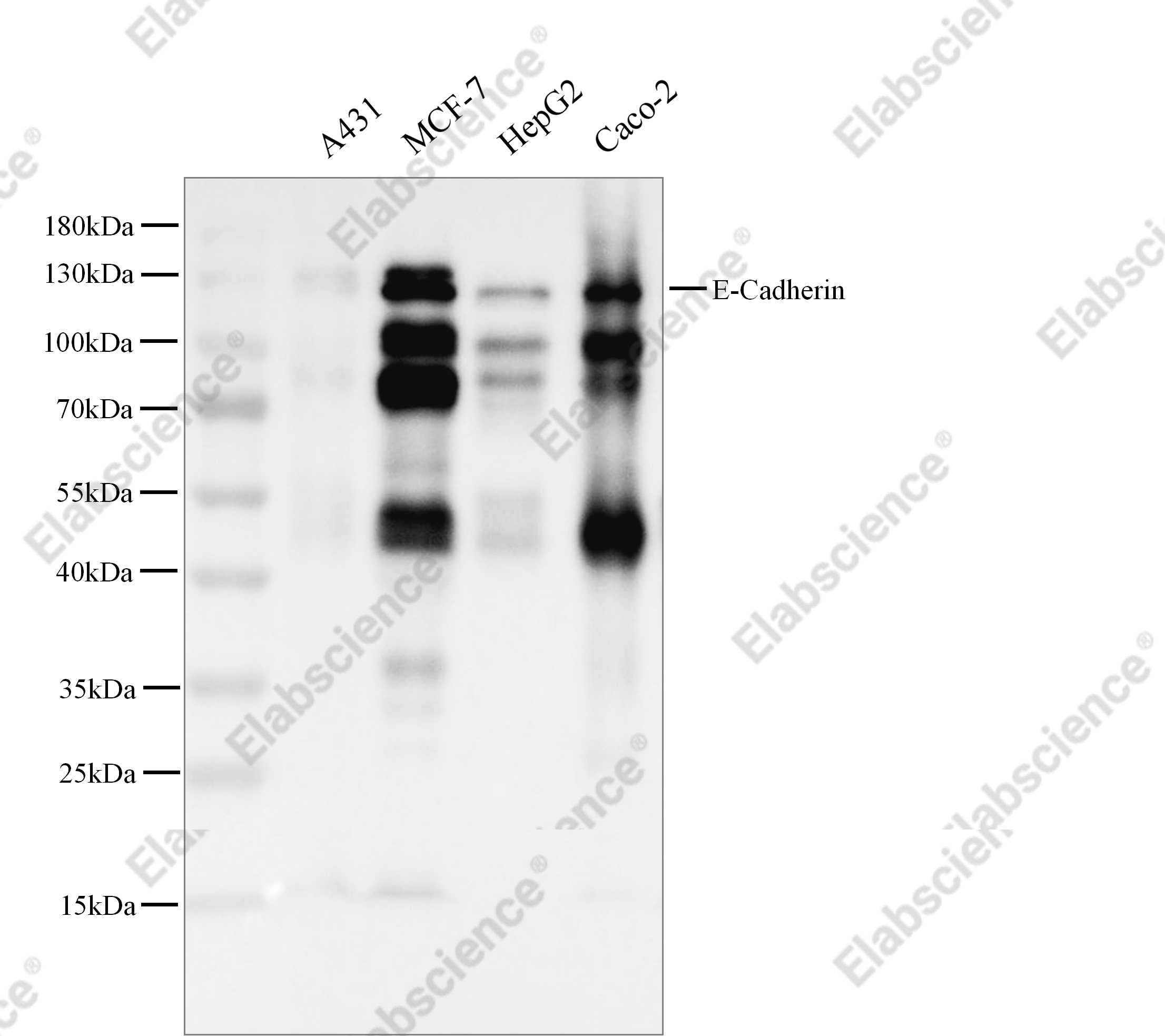 Recombinant E-Cadherin/CDH1/E-cad/CD324 Monoclonal Antibody - 3