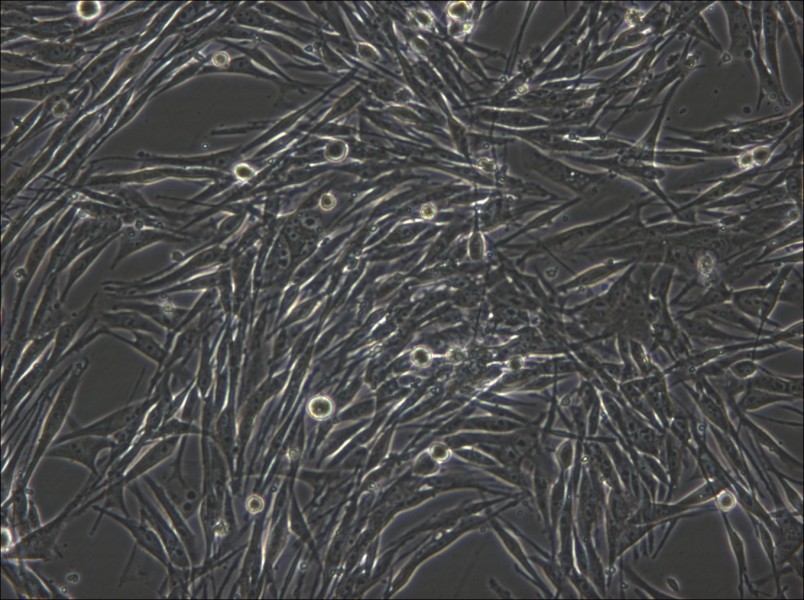 MeWo Cell Complete Medium - 6
