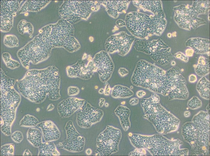 NCI-H1944 Cell Complete Medium - 3