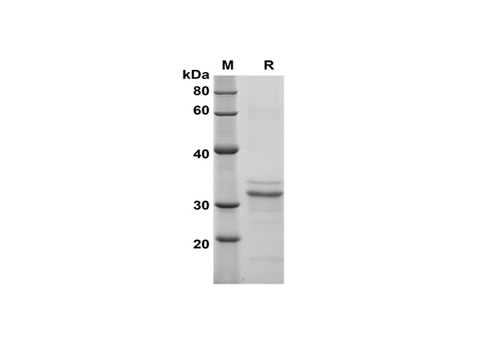 Recombinant Human BTN3A1/CD277 Protein(His Tag)-产品推荐-1