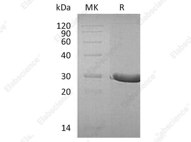 Recombinant Human DTD1 Protein (His Tag) - 1