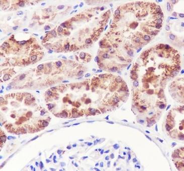 Recombinant ALDH7A1 Monoclonal Antibody-searchlist-2