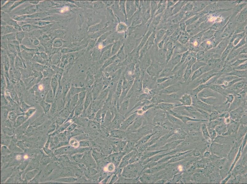 SW 982 [SW-982, SW982] (L15) Cell Complete Medium - small - 4