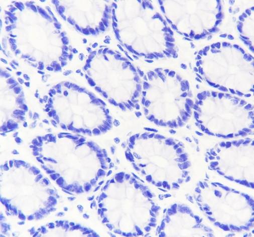 Recombinant INSL3 Monoclonal Antibody - 3