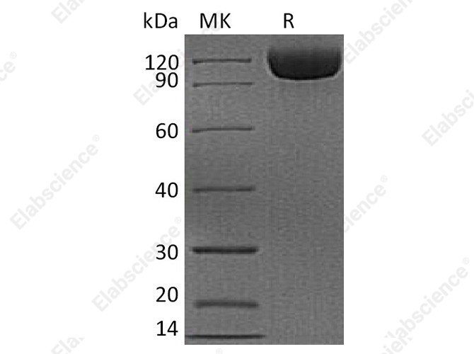 Recombinant Human DPP4/DPPIV/CD26 Protein (His Tag) - 1