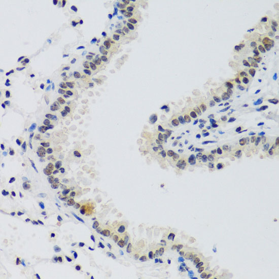 Immunohistochemistry of paraffin-embedded Mouse lung using CCNE2 Polyclonal Antibody at dilution of  1:100 (40x lens).