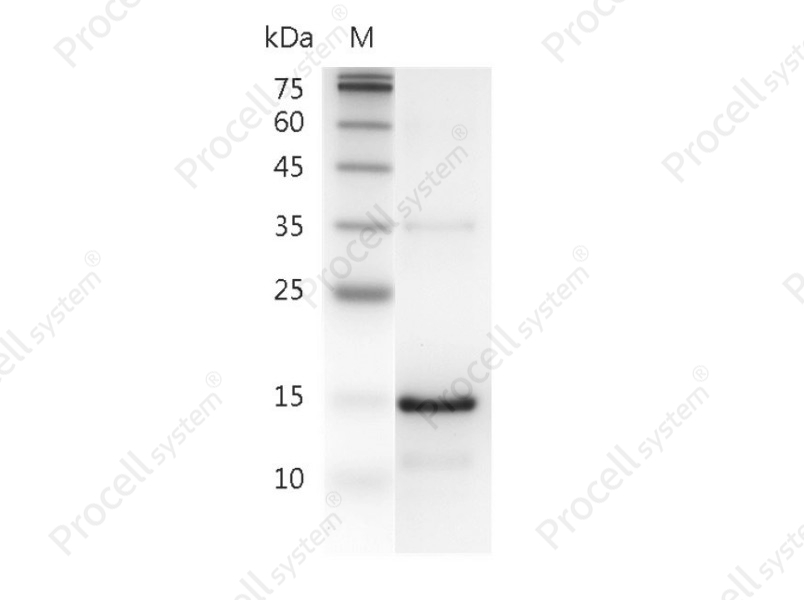 IL-21/Za11, Human, Recombinant