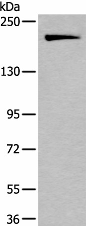 Western blot analysis of HUVEC cell lysate  using IQGAP1 Polyclonal Antibody at dilution of 1:300