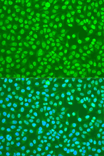 Immunofluorescence analysis of U2OS cells using HNRNPDL Polyclonal Antibody at dilution of  1:100. Blue: DAPI for nuclear staining.