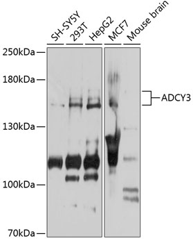 Western blot analysis of extracts of various cell lines using ADCY3 Polyclonal Antibody at 1:1000 dilution.