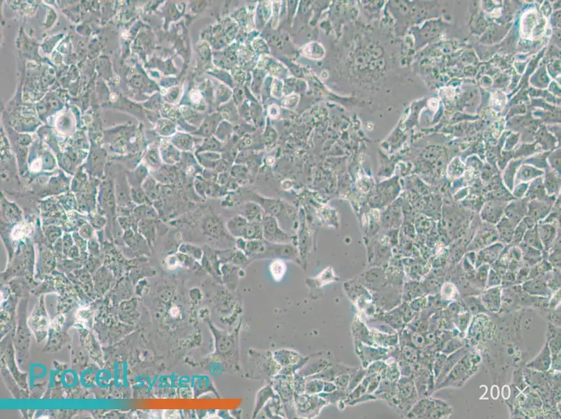 OV-90 Cell Complete Medium - small - 4