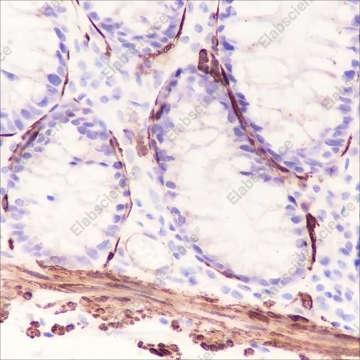 Recombinant Smooth Muscle Myosin heavy chain 11 Monoclonal Antibody - 2