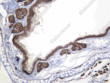Recombinant Cytokeratin 4 Monoclonal Antibody - 2