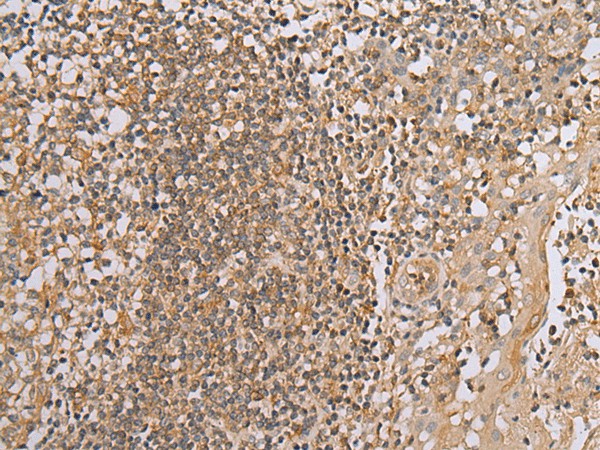 Immunohistochemistry of paraffin-embedded Human tonsil tissue  using BAG2 Polyclonal Antibody at dilution of 1:40(?200)