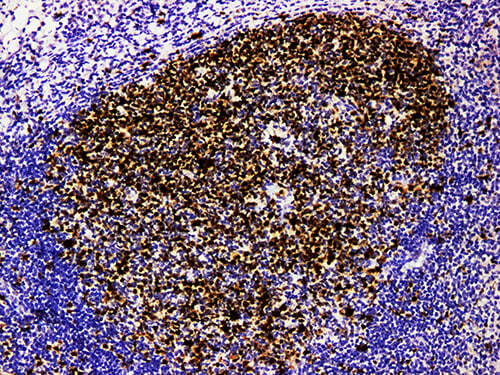 Immunohistochemistry of paraffinembedded Human tonsil tissue with Topoisomerase IIα Monoclonal Antibody (Antigen repaired by EDTA).