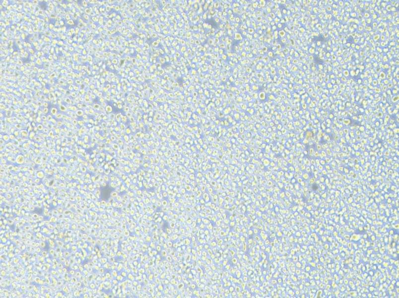 AMO1 Cell Complete Medium - 2